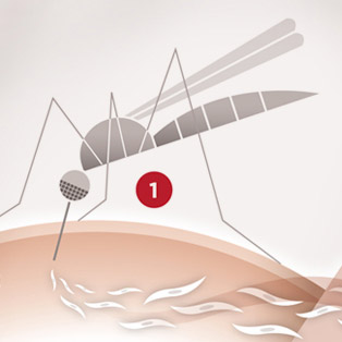 5W Samples - Malaria Lifecycle